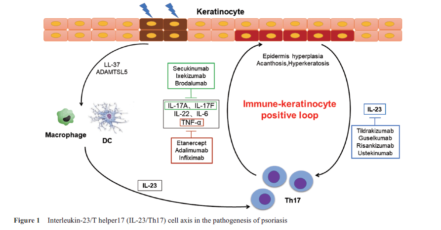 “银屑病研究新进展”